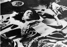 Hiroshima - Grossly Injured Woman