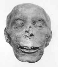 Tuthmosis III - A Mummy's Face