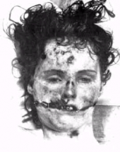 Lacerations on the Victim's Face - Elizabeth Short