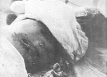 Japanese Occupation of the Philippines - Mortal Wounds
